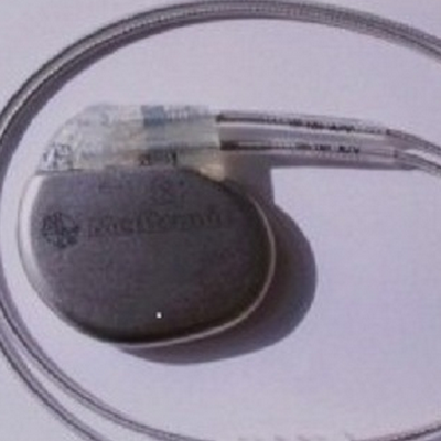 implantable pacemaker e10a1