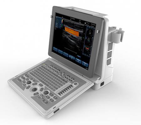 C80便携式全数字彩色多普勒超声诊断系统