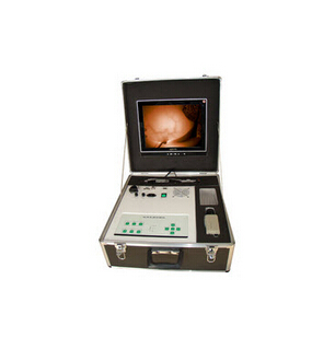 红外乳腺诊断仪 zj-8000b.