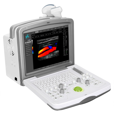 FDC6000 全数字彩色多普勒超声诊断系统