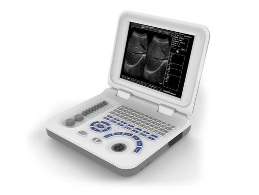 XF30数字B型超声诊断仪（笔记本式）