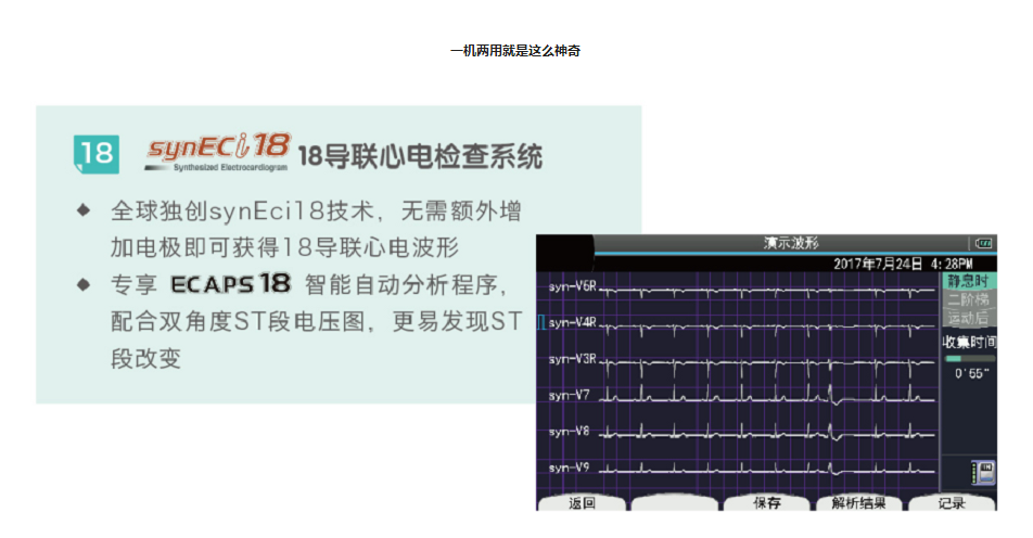 原装进口ECG-2360十二道心电图机3.png