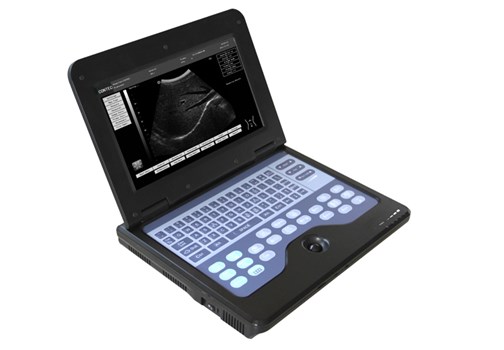 cms600p2b型笔记本式超声诊断仪/b超机