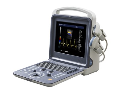 便携式全数字彩色超声诊断仪kz-02