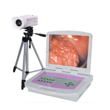 RCZ-3001型（普通款）数码电子阴道镜