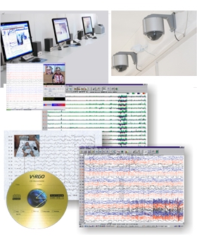 数字化视频脑电监护分析系统