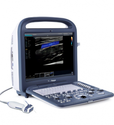 jkcs-s01超声诊断系统