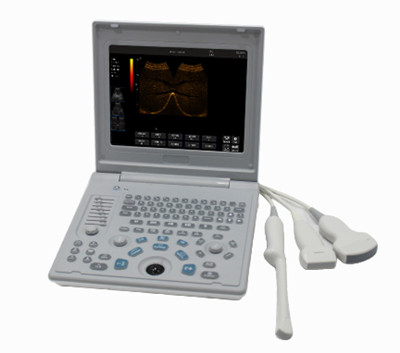 ss-6b 笔记本全数字超声诊断仪