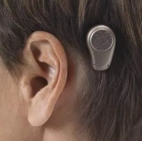 bn-803骨导式助听器