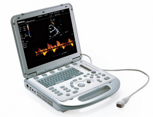 performance便携式彩色超声诊断系统