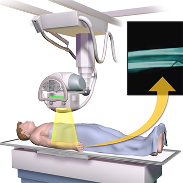 xhigs-a射治疗x射线图像引导系统