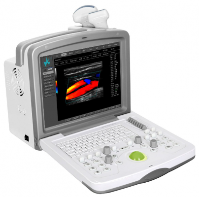 weye8平板式全数字彩色多普勒超声诊断系统