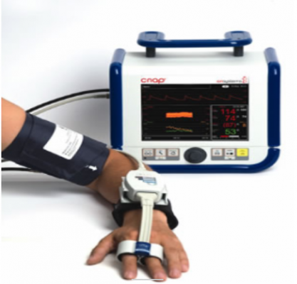 连续无创型血压监测系统cnap monitor 500 hd