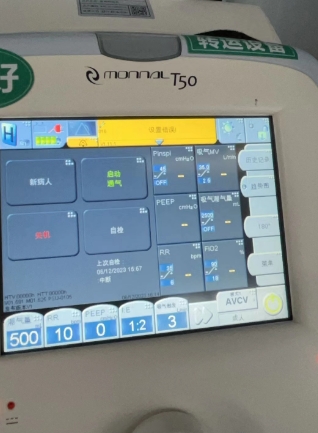 法国天马呼吸机主板电池加校准monnal t50