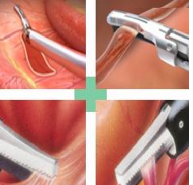 超声切割止血刀系统 CS1405P