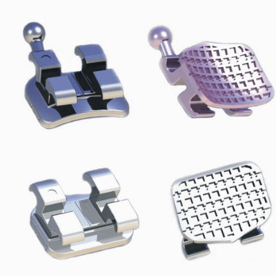 仿生整体直丝托槽