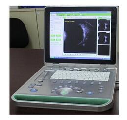 全数字超声显像诊断仪 ss-5