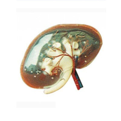 透明肾脏放大模型 gd/a14008