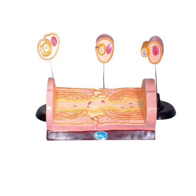 周围神经纤维髓鞘的发生和有髓纤维的超微结构 yj/zz2024