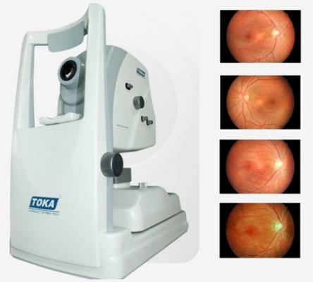 雷蒙光电tnf506眼底照相机