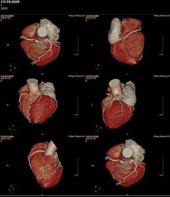 核医学放射胶片—医用ct胶片
