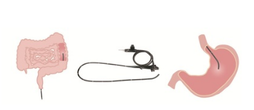 上消化道医用电子内镜oev-g166