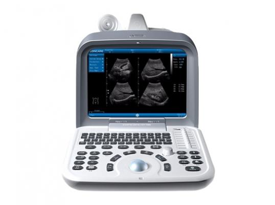 超声诊断仪  lp5 plus