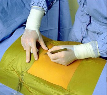 3m 含碘抗菌手术薄膜