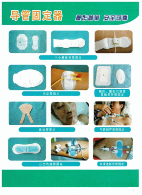 引流导管固定器