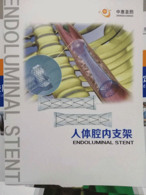 不锈钢支架/镍钛合金支架