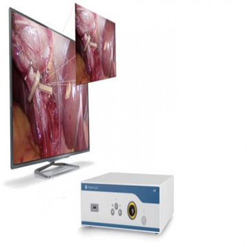 超高清4K摄像系统ES014301