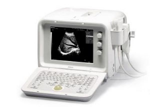 全数字超声诊断系统 DP-7