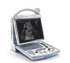 全数字便携式超声诊断系统 dp-10