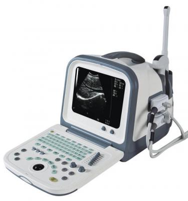 全数字超声显像诊断仪XProbe