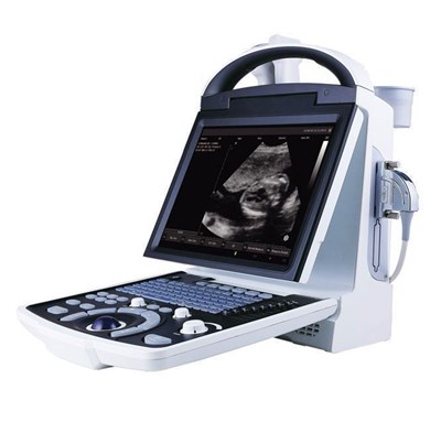 海鹰HY5533全数字超声诊断仪