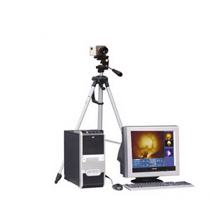 红外乳腺诊断仪 zj-8000b..