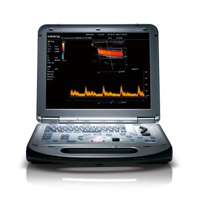 迈瑞 便携式彩色多普勒超声系统 M55