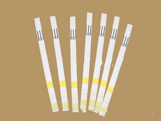 尿液分析试纸条（干化学法）