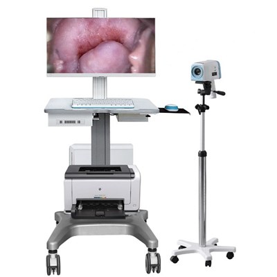 LJ-6000A型数码电子阴道镜