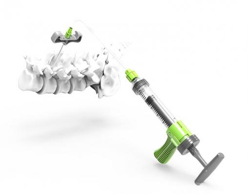 骨水泥推进器GTJ701