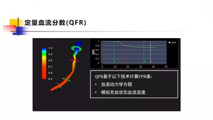 定量血流分数测量软件AngioPlus Core