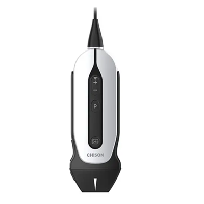 全数字掌上彩色多普勒超声诊断仪sonoeye p1