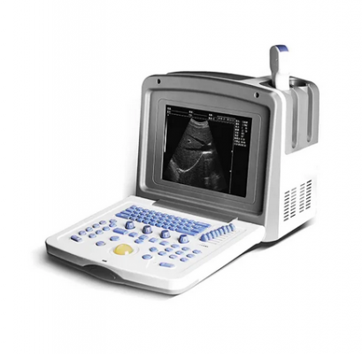 q1全数字手持式超声诊断仪