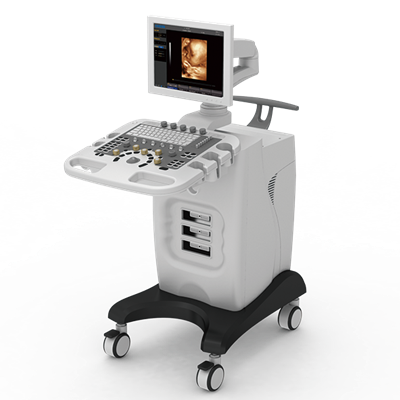 chison ivis 30全数字彩色超声诊断系统