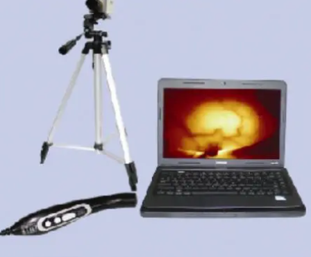 mscan1.0b乳腺组织阻抗分析仪