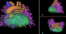 idps诊断图像处理软件