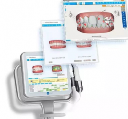 口内扫描仪aoralscan thunpure