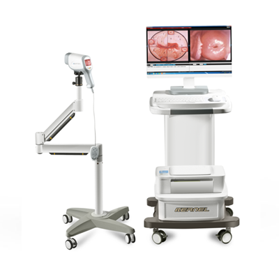 数字光学阴道镜sw-3302