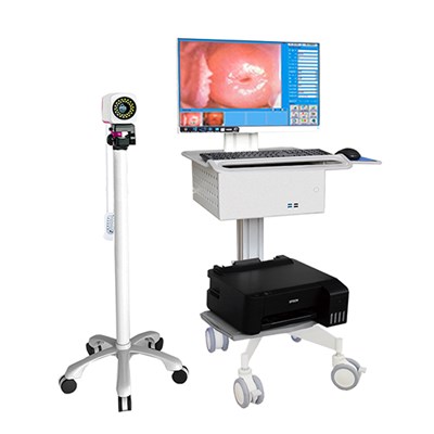 jy-2620电子阴道镜【高清】