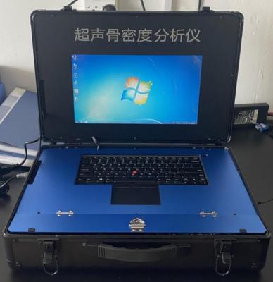 齐力超声骨密度分析仪ql3000a